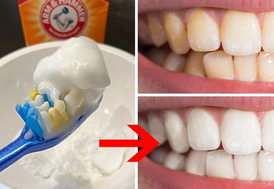 oil pulling for white teeth oil pulling for white teeth