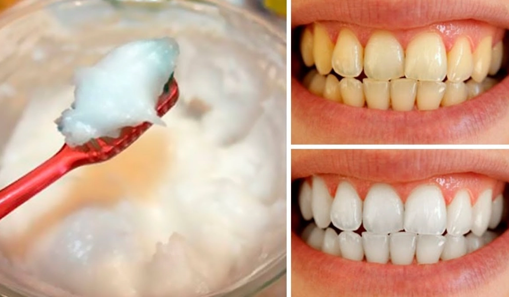 home teeth whitening without baking soda home teeth whitening without baking soda
