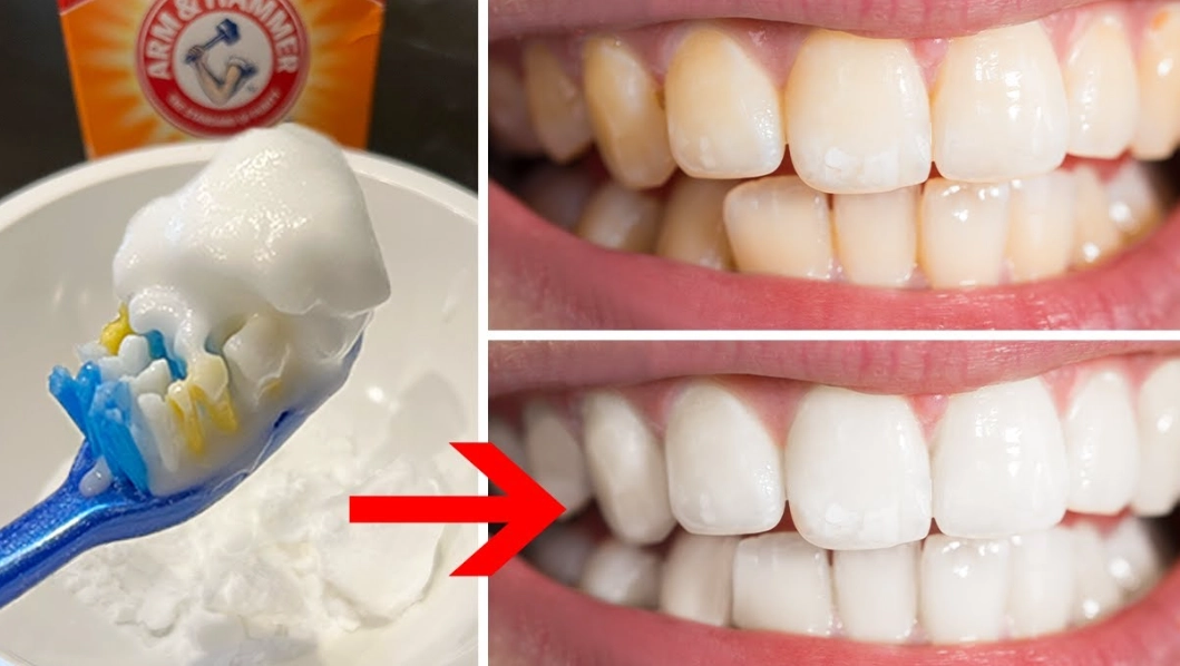 teeth whitening fast teeth whitening fast