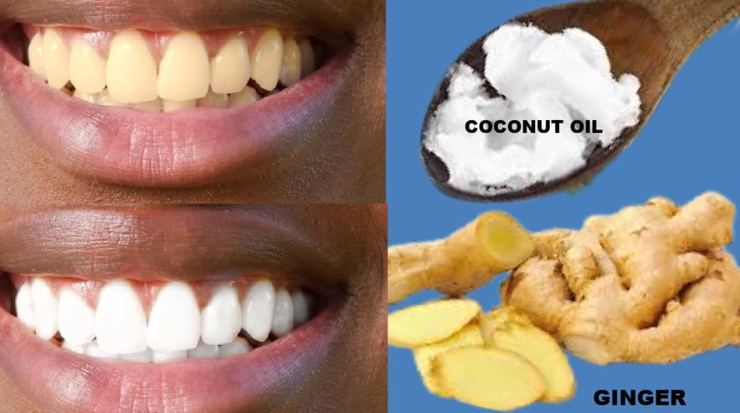 natural teeth whitening natural teeth whitening
