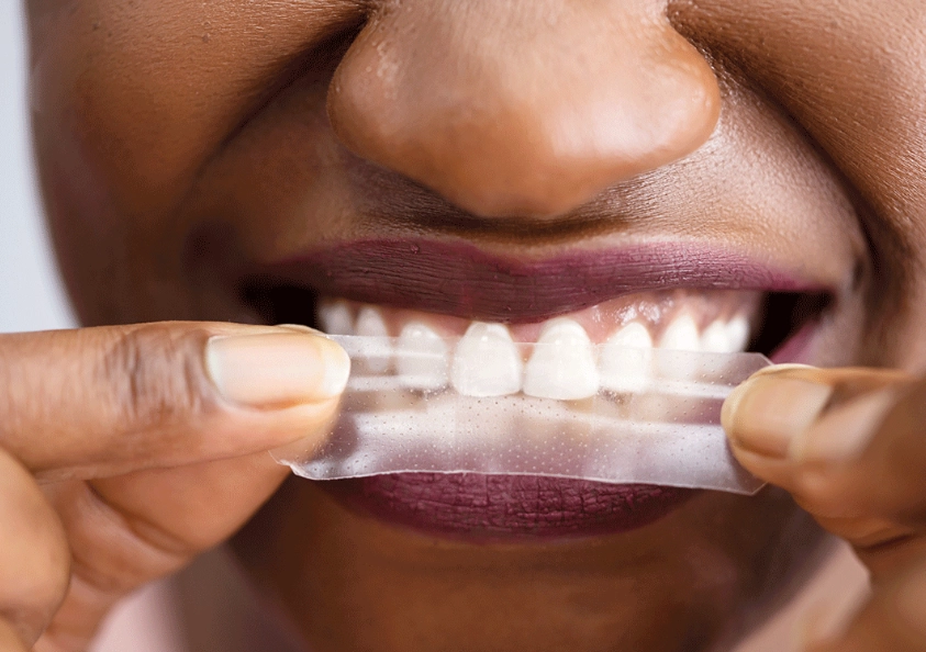 do crest white strips work do crest white strips work