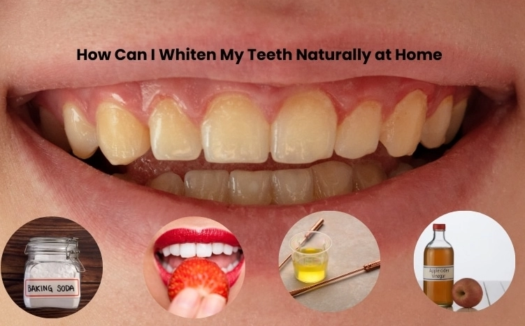 How to whiten teeth naturally at home