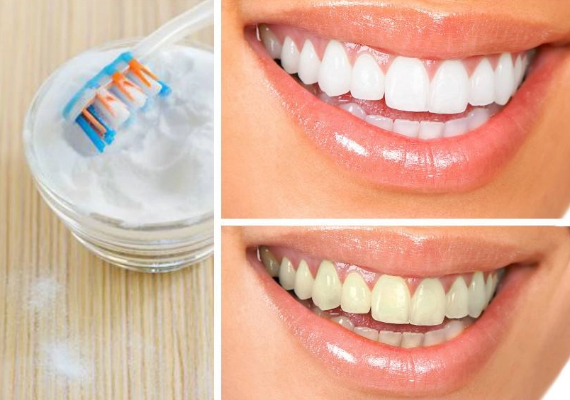 2 minute teeth whitening 2 minute teeth whitening