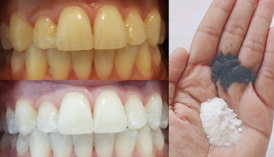 home teeth whitening kits home teeth whitening kits