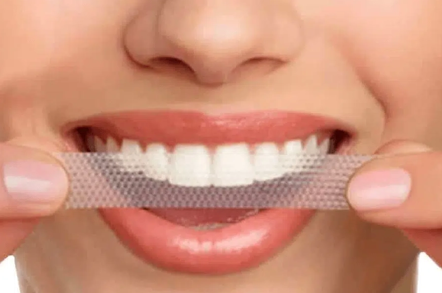 Do whitening strips work permanently